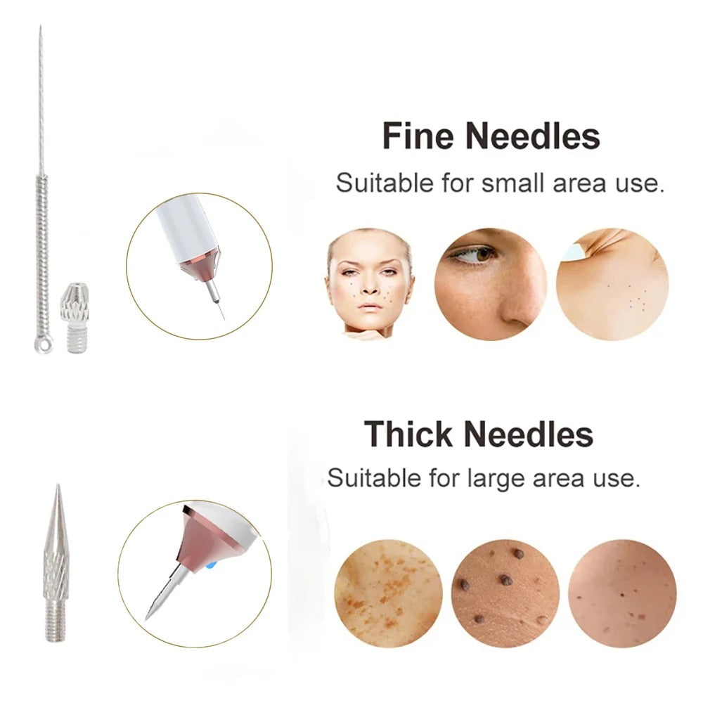 DermaClear Skin Tag Remover